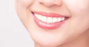 White Teeth Marks